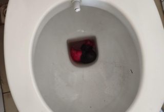 Klozete Döktü Ama Kurtulamadı!
