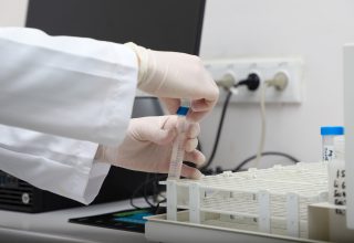 Sapanca Gölü’ndeki alg oluşumu mevsimsel