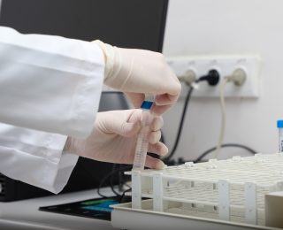 Sapanca Gölü’ndeki alg oluşumu mevsimsel